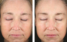 Load image into Gallery viewer, SkinBetter Science Mystro Revive Renewing Serum 30ml