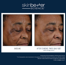Load image into Gallery viewer, Skinbetter Mystro Active Balance Serum 30ml