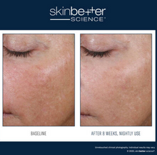 Load image into Gallery viewer, Skinbetter AlphaRet Overnight Cream