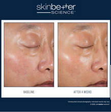 Load image into Gallery viewer, Skinbetter Duo Kit 30ml Two ground-breaking products to start your professional skincare journey.