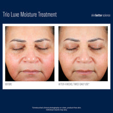 Load image into Gallery viewer, Skinbetter Science Trio Luxe Moisture Treatment