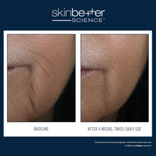 Load image into Gallery viewer, Skinbetter Science InterFuse Intensive Treatment Lines 15ml