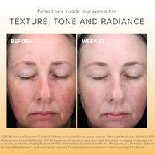 Load image into Gallery viewer, C-RADICAL Defense Antioxidant Serum