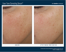Load image into Gallery viewer, Skinbetter Even Tone Correcting Serum 50 ml-