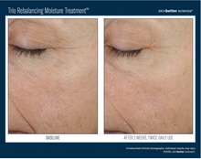 Load image into Gallery viewer, Skinbetter Science Trio Rebalancing Moisture Treatment