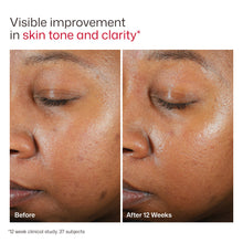 Load image into Gallery viewer, EltaMD UV Clear Tinted Broad-Spectrum SPF 46
