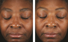 Load image into Gallery viewer, SkinBetter Science Mystro Revive Renewing Serum 30ml
