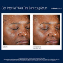 Load image into Gallery viewer, Skinbetter Science Even Intensive Skin Tone Correcting Serum
