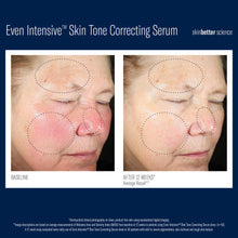 Load image into Gallery viewer, Skinbetter Science Even Intensive Skin Tone Correcting Serum
