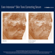 Load image into Gallery viewer, Skinbetter Science Even Intensive Skin Tone Correcting Serum
