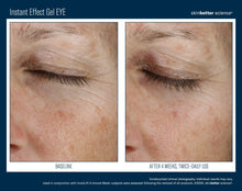 Load image into Gallery viewer, Skinbetter Instant Effect Eye Gel-Please call 604-773-1191 to place your order.
