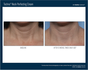 Skinbetter Health Techno Neck Perfecting Cream 50 ml-Please call 604-773-1191 to place your order.