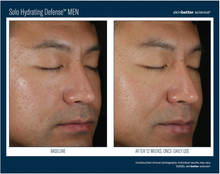Load image into Gallery viewer, Skinbetter Science Solo Hydrating Defense -
