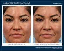 Load image into Gallery viewer, Skinbetter  ScienceTone Smart Priming Compact FACE- Please call 604-773-1191 to place your order.
